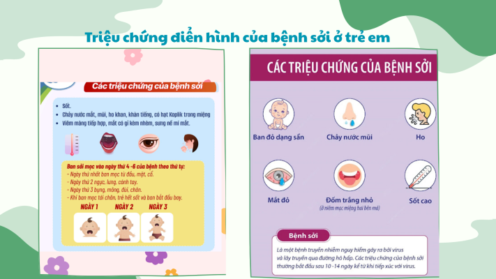 bệnh sởi ở trẻ em